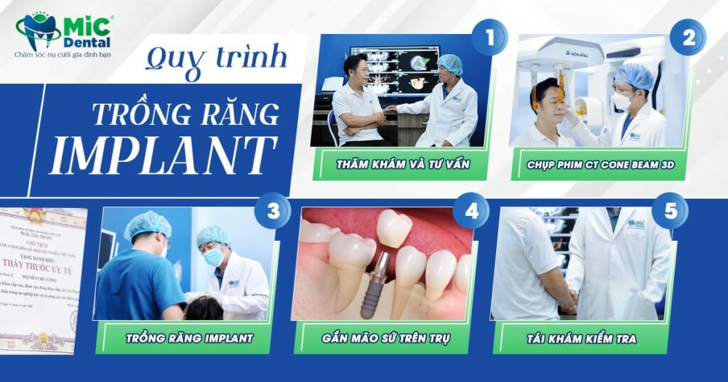 Góc Giải Đáp MIC: Trồng Răng Implant Có Đau Không? 5