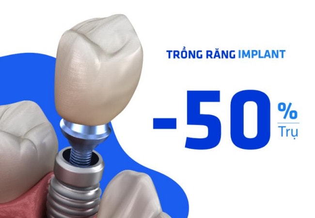 Chọn dịch vụ trồng răng Implant giá rẻ giúp tiết kiệm chi phí