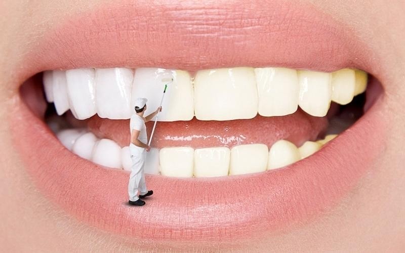 Đánh răng ít nhất 2 lần/ngày để loại bỏ vi khuẩn, mảng bám gây sâu răng