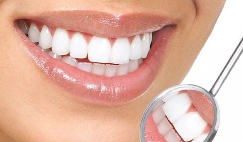 Định kỳ lấy cao răng 2 lần/năm để giúp bảo vệ răng miệng chắc khỏe